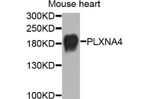 Western blot analysis of extracts of mouse heart cells, using PLXNA4 antibody. (Plexin A4 Antikörper)