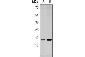 Western blot analysis of SUMO4 expression in Jurkat (A), MCF7 (B) whole cell lysates.