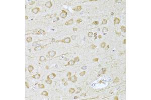 Immunohistochemistry of paraffin-embedded rat brain using FDPS Antibody (ABIN5973369) at dilution of 1/100 (40x lens).