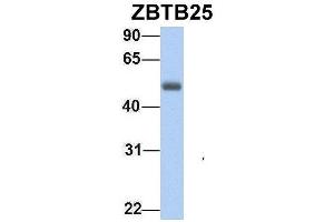 Western Blotting (WB) image for anti-Zinc Finger and BTB Domain Containing 25 (ZBTB25) (Middle Region) antibody (ABIN2780821)