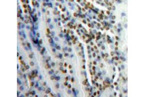 Used in DAB staining on fromalin fixed paraffin-embedded Kidney tissue (SNRPC Antikörper  (AA 2-159))