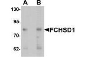 Western blot analysis of FCHSD1 in MCF7 cell lysate with FCHSD1 Antibody  at (A) 0.