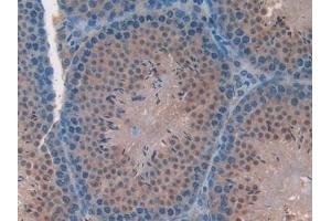Immunohistochemistry (IHC) image for anti-Family with Sequence Similarity 19 (Chemokine (C-C Motif)-Like), Member A2 (FAM19A2) (AA 31-119) antibody (ABIN7439783)
