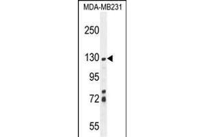 ZSWIM6 Antibody (C-term) (ABIN654590 and ABIN2844290) western blot analysis in MDA-M cell line lysates (35 μg/lane). (ZSWIM6 Antikörper  (C-Term))
