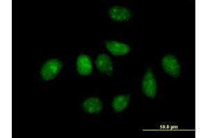 Immunofluorescence of purified MaxPab antibody to PLK1 on HeLa cell. (PLK1 Antikörper  (AA 1-603))
