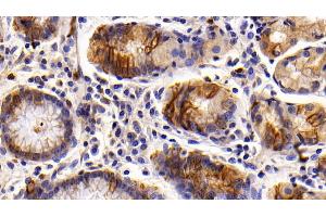 Detection of KRT6A in Human Stomach Tissue using Polyclonal Antibody to Keratin 6A (KRT6A) (KRT6A Antikörper  (AA 163-468))
