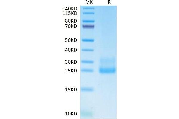 CD69 Protein (CD69) (AA 62-199) (His tag)