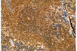 ABIN6261268 and ABIN6272941 at 1/100 staining Rat spleen tissue by IHC-P. (DEK Antikörper  (Internal Region))