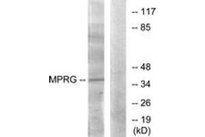 Western blot analysis of extracts from HuvEc cells, using MPRG Antibody. (PAQR5 Antikörper  (AA 281-330))