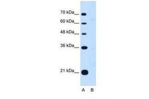 Image no. 1 for anti-Downstream Neighbor of SON (DONSON) (AA 301-350) antibody (ABIN6738192) (DONSON Antikörper  (AA 301-350))
