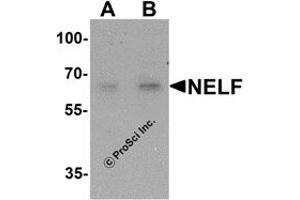 Western Blotting (WB) image for anti-NMDA Receptor Synaptonuclear Signaling and Neuronal Migration Factor (NSMF) antibody (ABIN1077438) (NMDA Receptor Synaptonuclear Signaling and Neuronal Migration Factor (NSMF) Antikörper)