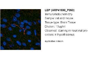 Image no. 1 for anti-Leptin (LEP) (Middle Region) antibody (ABIN502160) (Leptin Antikörper  (Middle Region))