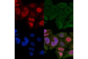 ABIN6264195 and ABIN6266861 staining Hela cells by IF/ICC.