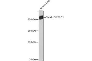 Western blot analysis of extracts of Mouse lung, using SMMHC/SMMHC/MYH11 Rabbit mAb (ABIN7268745) at 1:1000 dilution. (MYH11 Antikörper)