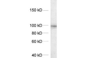 dilution: 1 : 1000, sample: crude synaptosomal fraction of rat brain (P2) (DLG2 Antikörper  (AA 22-37))