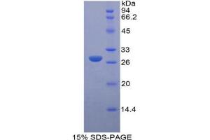 SDS-PAGE analysis of Mouse LOXL3 Protein.