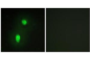 Immunofluorescence analysis of HUVEC cells, using hnRNP C1/C2 antibody. (HNRNPC Antikörper  (C-Term))
