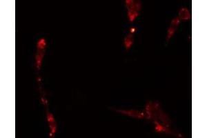 ABIN6275052 staining  A549 cells by IF/ICC. (APPL1 Antikörper  (Internal Region))