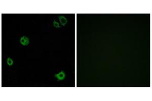 Immunofluorescence analysis of A549 cells, using GPR110 antibody. (G Protein-Coupled Receptor 110 Antikörper  (C-Term))