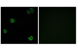Immunofluorescence analysis of A549 cells, using GPR110 antibody.