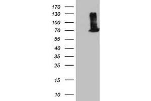 Western Blotting (WB) image for anti-EPM2A (Laforin) Interacting Protein 1 (EPM2AIP1) antibody (ABIN1498046)