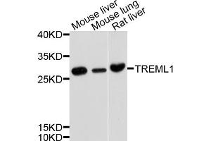 Western blot analysis of extracts of various cell lines, using TREML1 antibody (ABIN4905487) at 1:1000 dilution. (TREML1 Antikörper)