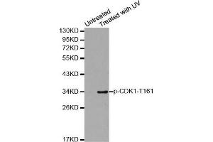 Western blot analysis of extracts from Hela cells using Phospho-CDK1-T161 antibody. (CDK1 Antikörper  (pThr161))