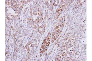 IHC-P Image Immunohistochemical analysis of paraffin-embedded A549 xenograft, using RPS10, antibody at 1:500 dilution. (RPS10 Antikörper)