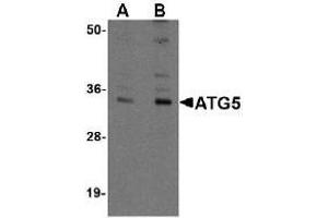 Western blot. (ATG5 Antikörper  (N-Term))