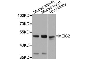 Western blot analysis of extracts of various cell lines, using MEIS2 antibody. (MEIS2 Antikörper)