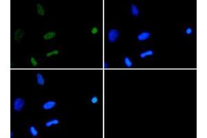 Immunofluorescence of Rabbit Anti-Histone H3 [ac Lys18] Antibody. (Histone 3 Antikörper  (H3K18ac))