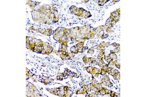 IHC analysis of CD2AP using anti-CD2AP antibody (ABIN6719544). (CD2AP Antikörper  (AA 253-337))