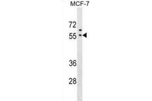 Western Blotting (WB) image for anti-Golgi Reassembly Stacking Protein 1, 65kDa (GORASP1) antibody (ABIN2999862) (GORASP1 Antikörper)