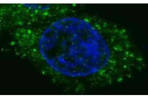 Immunofluorescence (IF) image for anti-Met Proto-Oncogene (MET) antibody (ABIN2995277) (c-MET Antikörper)