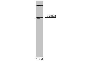 Western blot analysis of Btk on EB1 lysate. (BTK Antikörper  (N-Term))