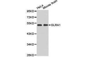 Western Blotting (WB) image for anti-Glycine Receptor, alpha 1 (GLRA1) antibody (ABIN1872831) (GLRA1 Antikörper)