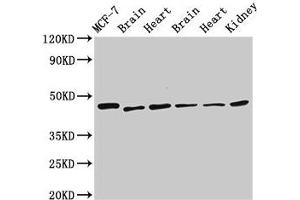 Western Blot Positive WB detected in: MCF-7 whole cell lysate, Rat brain tissue, Rat heart tissue, Mouse brain tissue, Mouse heart tissue, Mouse kidney tissue All lanes: DKC1 antibody at 2. (DKC1 Antikörper  (AA 94-170))