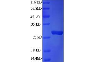 SDS-PAGE (SDS) image for RAB3A Interacting Protein (Rabin3)-Like 1 (RAB3IL1) (AA 21-247) protein (His tag) (ABIN4976057) (RAB3IL1 Protein (AA 21-247) (His tag))