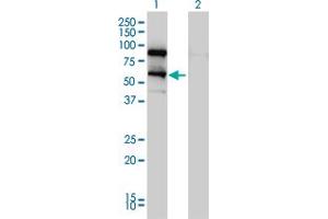 Western Blot analysis of DDX41 expression in transfected 293T cell line by DDX41 monoclonal antibody (M01), clone 2F4. (DDX41 Antikörper  (AA 523-622))