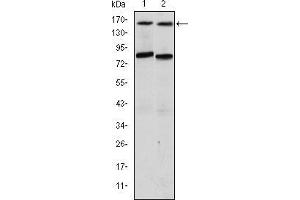 Western blot analysis using AIB1 mouse mAb against T47D (1) and MCF-7 (2) cell lysate. (NCOA3 Antikörper)