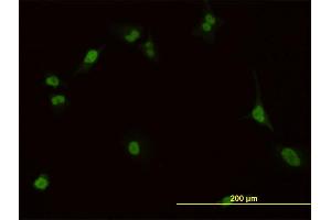Immunofluorescence of monoclonal antibody to PBX1 on HeLa cell. (PBX1 Antikörper  (AA 213-321))