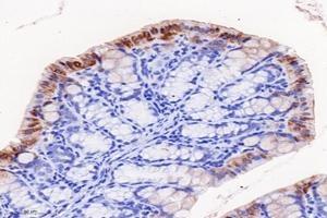 Immunohistochemistry analysis of paraffin-embedded mouse colon using,FGF10 (ABIN7073940) at dilution of 1: 8000 (FGF10 Antikörper)