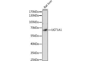 Western blot analysis of extracts of Rat liver, using UGT1 antibody (ABIN6132769, ABIN6149895, ABIN6149896 and ABIN6221779) at 1:2130 dilution. (UGT1A1 Antikörper  (AA 1-200))