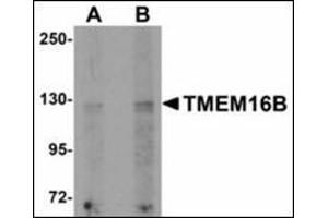 Western blot analysis of TMEM16B in rat brain tissue lysate with TMEM16B antibody at (A) 1 and (B) 2 µg/ml. (Anoctamin 2 Antikörper  (N-Term))