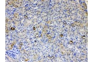 IHC testing of FFPE mouse kidney tissue with ALDH1A3 antibody at 1ug/ml.