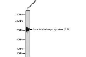 Western blot analysis of extracts of Mouse testis, using Placental alkaline phosphatase (PLAP) Rabbit mAb (ABIN1682693, ABIN7101664, ABIN7101665 and ABIN7101666) at 1:1000 dilution. (PLAP Antikörper)