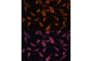 Immunofluorescence analysis of L929 cells using FBLN5 Polyclonal Antibody (ABIN6127927, ABIN6140497, ABIN6140498 and ABIN6225300) at dilution of 1:100 (40x lens). (Fibulin 5 Antikörper  (AA 199-448))