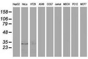 Image no. 2 for anti-Eukaryotic Translation Initiation Factor 4E Family Member 2 (EIF4E2) antibody (ABIN1497993) (EIF4E2 Antikörper)
