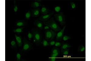 Immunofluorescence of monoclonal antibody to HIPK1 on HeLa cell. (HIPK1 Antikörper  (AA 330-430))