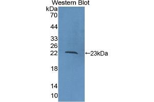 Detection of Recombinant COL16, Human using Polyclonal Antibody to Collagen Type XVI (COL16)